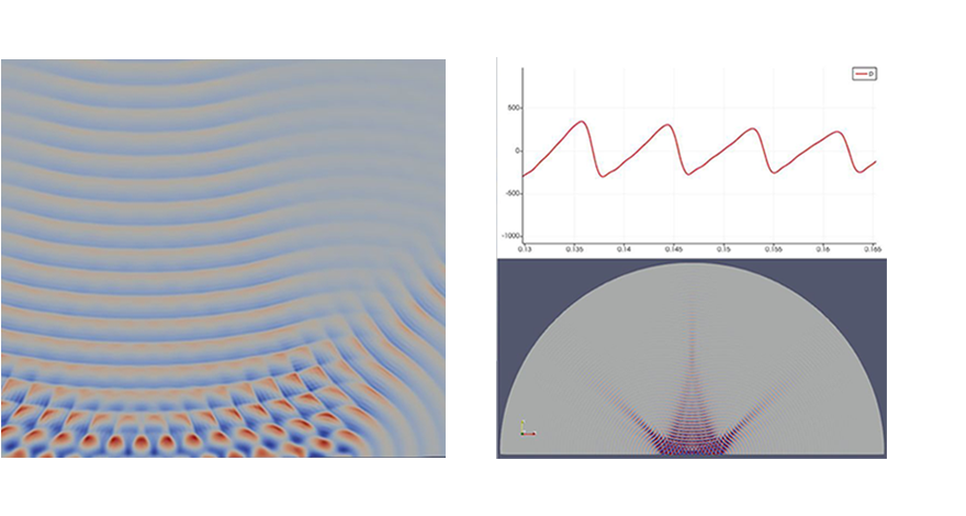 ultrasound-waves-simulation-2-1